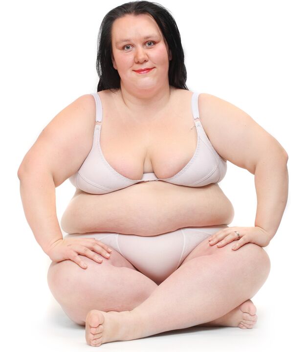 Overweight women